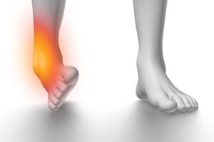 How to Treat Ankle Injury: Best Treatment Options for Ankle Injuries