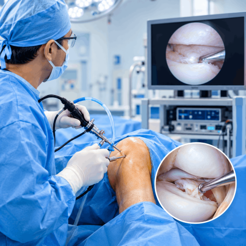 Best Arthroscopy Doctor in Wakad